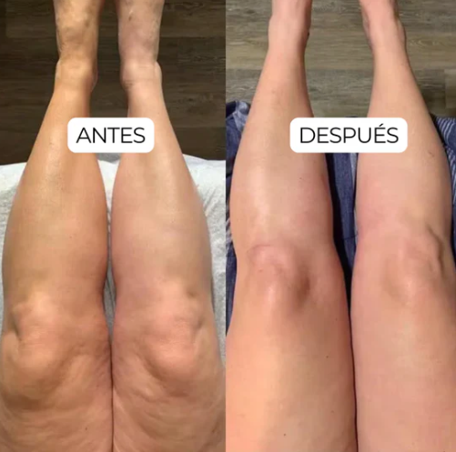 Dile Adiós a la inflamación crónica con Drenaje Linfático natural