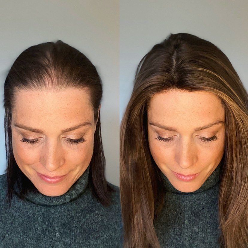 Hair Growth® – Cabello Más Largo, Fuerte y Hermoso Desde la Raíz